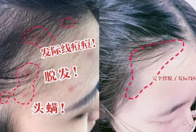 ？10分钟轻松养成女明星「绸缎发」开元棋牌洗完头自然风干还是吹干好(图17)